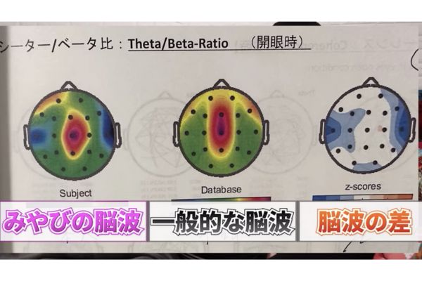 破天荒夫婦みやびの脳は